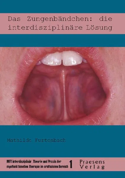 Das Zungenbändchen: die interdisziplinäre Lösung: Sprachtherapeuten in Zusammenarbeit mit Kieferorthopäden, Stillberaterinnen und chirurgisch tätigen ... Therapie im orofazialen Bereich)