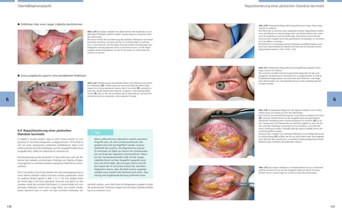 Bildatlas Lidchirurgie: Angewandte Anatomie | Untersuchung | Plastische Lidchirurgie