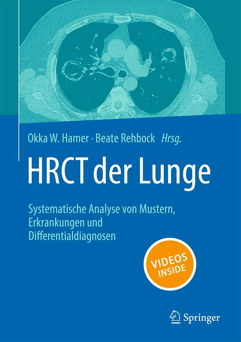 HRCT der Lunge: Systematische Analyse von Mustern, Erkrankungen und Differenzialdiagnosen